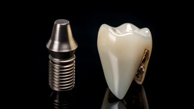 Vì Sao Nên Trồng Implant?